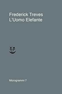 L’ UOMO ELEFANTE